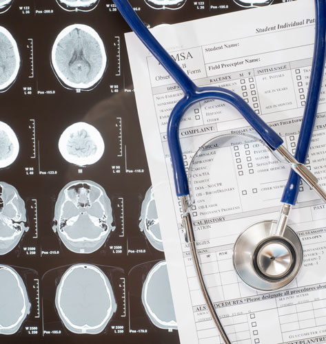 medical brain scan