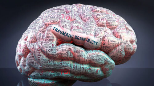 A close up of a brain, highlighting subtle signs that could indicate evidence of a mild brain injury.